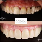 Business 3 image AAKAAR DENTISTRY | DENTAL CLINIC IN BANDRA Dental Clinics in Mumbai MH