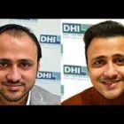 Business 1 image DHI - HAIR TRANSPLANT CLINIC IN NOIDA Hair Stylists in Noida UP