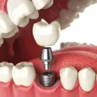 Business 5 image DR. PK DENTAL ARBOR - BEST DENTAL CLINIC IN KANAKAPURA MAIN RD, BANGALORE Dentists & Dental Clinics in Bengaluru KA
