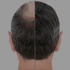 Business 3 image EUDERMIZ SKIN, HAIR & LASER CENTER - NALLAGANDLA, HYDERABAD Dermatologist in Hyderabad TG