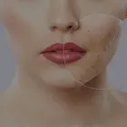 Business 4 image EUDERMIZ SKIN, HAIR & LASER CENTER - NALLAGANDLA, HYDERABAD Dermatologist in Hyderabad TG