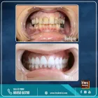 Business 7 image FMS INTERNATIONAL DENTAL CENTER Dentists & Dental Clinics in Cochin KL