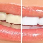 Business 1 image GEETANJALIDENTAL Dentists in South Delhi DL