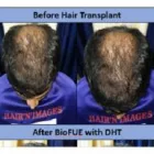 Business 1 image HAIR N IMAGES - HAIR TRANSPLANT CLINIC IN SURAT Beauty Services in Vapi GJ