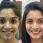 Business 3 image INVISALIGN ALIGNERS PROVIDER - PUNE Invisalign in Pune MH