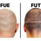 Business 6 image KEHA SKIN AND HAIR CLINIC Dermatologist in Hyderabad TG
