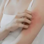 Business 3 image KESHAVAA'S SKIN,HAIR & LASER CLINIC Dermatologist in Thane MH
