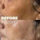 Business 3 image MAHI SKIN, HAIR & LASER CLINIC, KILPAUK Skin Care Treatment in Chennai TN