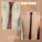 Business 1 image MAHI SKIN, HAIR & LASER CLINIC, SOWCARPET Skin Care Clinics in Chennai TN