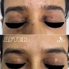 Business 3 image MAHI SKIN, HAIR & LASER CLINIC, SOWCARPET Skin Care Clinics in Chennai TN