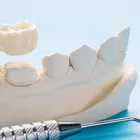 Business 4 image PRADHAM DENTAL - KONDAPUR Dentist in Hyderabad TG