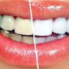 Business 2 image TATTVA DENTAL CARE - BEST DENTAL CLINIC IN PADMANABHANAGAR,BANASHANKARI Dental Clinics in Bengaluru KA