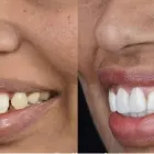 Business 3 image TATTVA DENTAL CARE - BEST DENTAL CLINIC IN PADMANABHANAGAR,BANASHANKARI Dental Clinics in Bengaluru KA