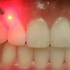 Business 6 image TATTVA DENTAL CARE - BEST DENTAL CLINIC IN PADMANABHANAGAR,BANASHANKARI Dental Clinics in Bengaluru KA