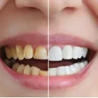 Business 8 image TATTVA DENTAL CARE - BEST DENTAL CLINIC IN PADMANABHANAGAR,BANASHANKARI Dental Clinics in Bengaluru KA
