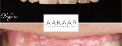 Business 3 image AAKAAR DENTISTRY | DENTAL CLINIC IN BANDRA Dental Clinics in Mumbai MH