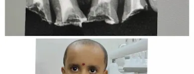 Business 2 image AESTHETIC DENTAL CLINIC Dental Clinics in Navi Mumbai MH