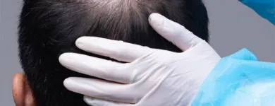 Business 2 image AMAYA SKIN, HAIR & AESTHETIC CLINIC - MADHAPUR/JUBILEE HILLS, HYDERABAD Dermatologist in Hyderabad TG