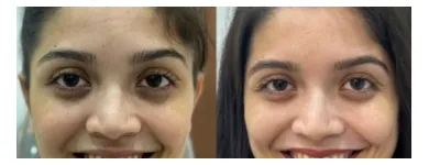 Business 3 image INVISALIGN ALIGNERS PROVIDER - PUNE Invisalign in Pune MH