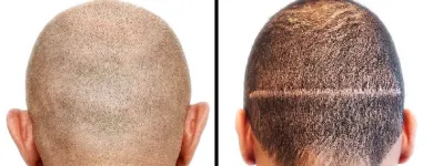 Business 6 image KEHA SKIN AND HAIR CLINIC Dermatologist in Hyderabad TG