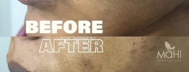 Business 1 image MAHI SKIN, HAIR & LASER CLINIC, KILPAUK Skin Care Treatment in Chennai TN