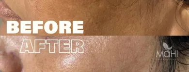 Business 3 image MAHI SKIN, HAIR & LASER CLINIC, KILPAUK Skin Care Treatment in Chennai TN