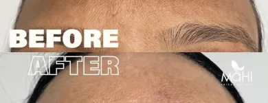 Business 4 image MAHI SKIN, HAIR & LASER CLINIC, KILPAUK Skin Care Treatment in Chennai TN