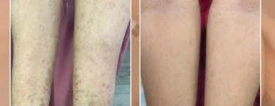 Business 6 image MAHI SKIN, HAIR & LASER CLINIC, KILPAUK Skin Care Treatment in Chennai TN