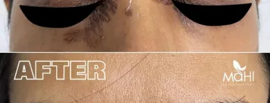 Business 3 image MAHI SKIN, HAIR & LASER CLINIC, SOWCARPET Skin Care Clinics in Chennai TN