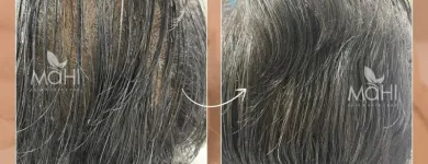 Business 4 image MAHI SKIN, HAIR & LASER CLINIC, SOWCARPET Skin Care Clinics in Chennai TN