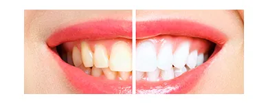 Business 1 image PRADHAM DENTAL - KONDAPUR Dentist in Hyderabad TG