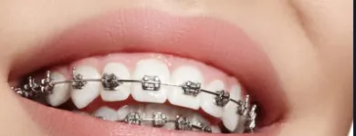 Business 1 image TATTVA DENTAL CARE - BEST DENTAL CLINIC IN PADMANABHANAGAR,BANASHANKARI Dental Clinics in Bengaluru KA