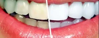 Business 2 image TATTVA DENTAL CARE - BEST DENTAL CLINIC IN PADMANABHANAGAR,BANASHANKARI Dental Clinics in Bengaluru KA