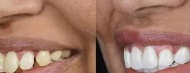 Business 3 image TATTVA DENTAL CARE - BEST DENTAL CLINIC IN PADMANABHANAGAR,BANASHANKARI Dental Clinics in Bengaluru KA