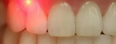 Business 6 image TATTVA DENTAL CARE - BEST DENTAL CLINIC IN PADMANABHANAGAR,BANASHANKARI Dental Clinics in Bengaluru KA