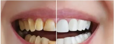 Business 8 image TATTVA DENTAL CARE - BEST DENTAL CLINIC IN PADMANABHANAGAR,BANASHANKARI Dental Clinics in Bengaluru KA