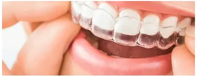 Business 9 image TATTVA DENTAL CARE - BEST DENTAL CLINIC IN PADMANABHANAGAR,BANASHANKARI Dental Clinics in Bengaluru KA