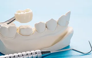 Business 4 image PRADHAM DENTAL - KONDAPUR