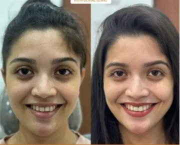 Business 3 image INVISALIGN ALIGNERS PROVIDER - PUNE