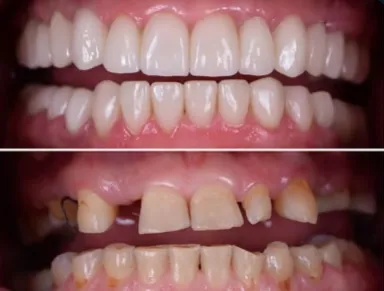 Business 7 image TATTVA DENTAL CARE - BEST DENTAL CLINIC IN PADMANABHANAGAR,BANASHANKARI