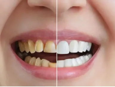 Business 8 image TATTVA DENTAL CARE - BEST DENTAL CLINIC IN PADMANABHANAGAR,BANASHANKARI