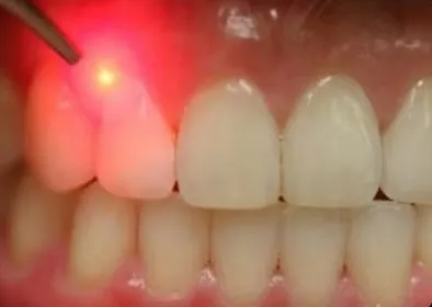 Business 6 image TATTVA DENTAL CARE - BEST DENTAL CLINIC IN PADMANABHANAGAR,BANASHANKARI