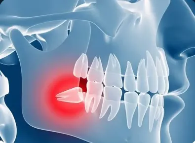 Business 5 image TATTVA DENTAL CARE - BEST DENTAL CLINIC IN PADMANABHANAGAR,BANASHANKARI