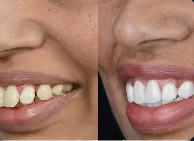 Business 3 image TATTVA DENTAL CARE - BEST DENTAL CLINIC IN PADMANABHANAGAR,BANASHANKARI