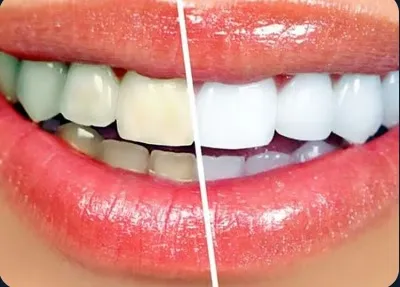 Business 2 image TATTVA DENTAL CARE - BEST DENTAL CLINIC IN PADMANABHANAGAR,BANASHANKARI