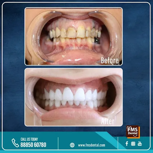 Business 7 image FMS INTERNATIONAL DENTAL CENTER