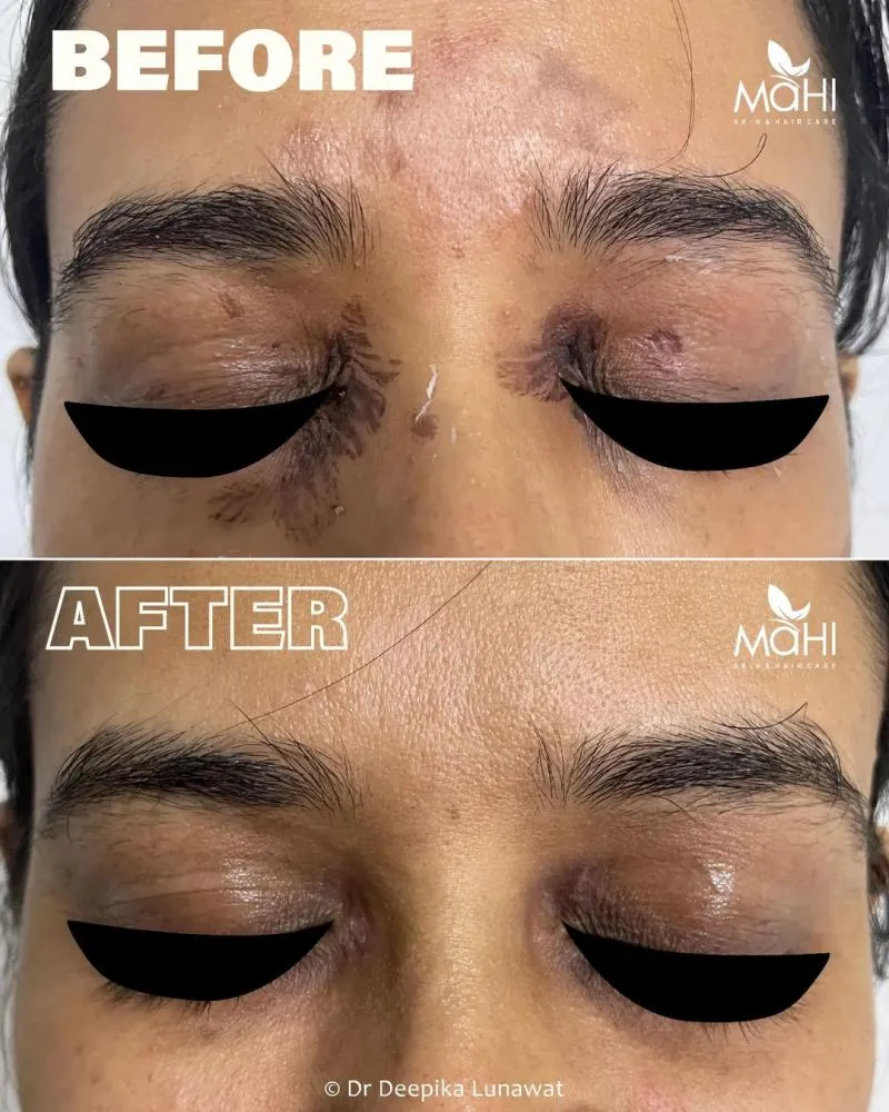 Business 3 image MAHI SKIN, HAIR & LASER CLINIC, SOWCARPET