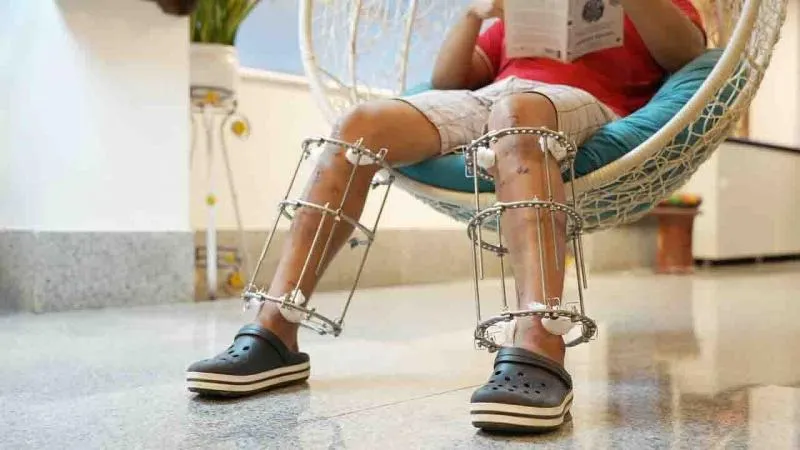 Business 3 image HEIGHTS PLUS - LIMB LENGTHENING SURGERY AND REHABILITATION CENTRE IN INDIA