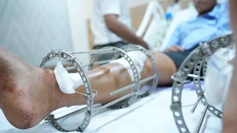 Business 5 image HEIGHTS PLUS - LIMB LENGTHENING SURGERY AND REHABILITATION CENTRE IN INDIA