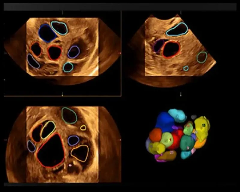 Business 4 image KRISHNA IVF CLINIC